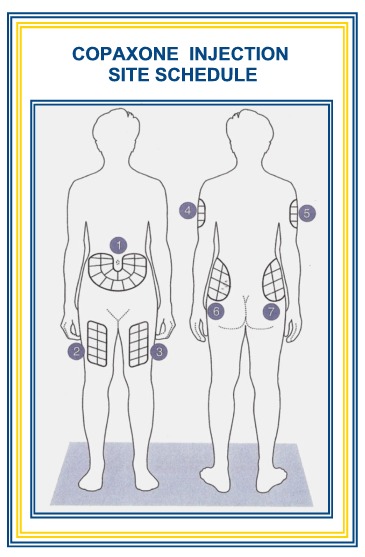 Copaxone Injection Sites - Body Illustration