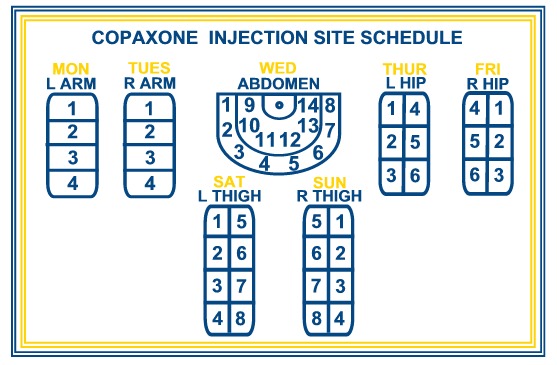 Copaxone Injection Sites Chart